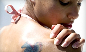 51% Off at Serenity Tattoo Removal